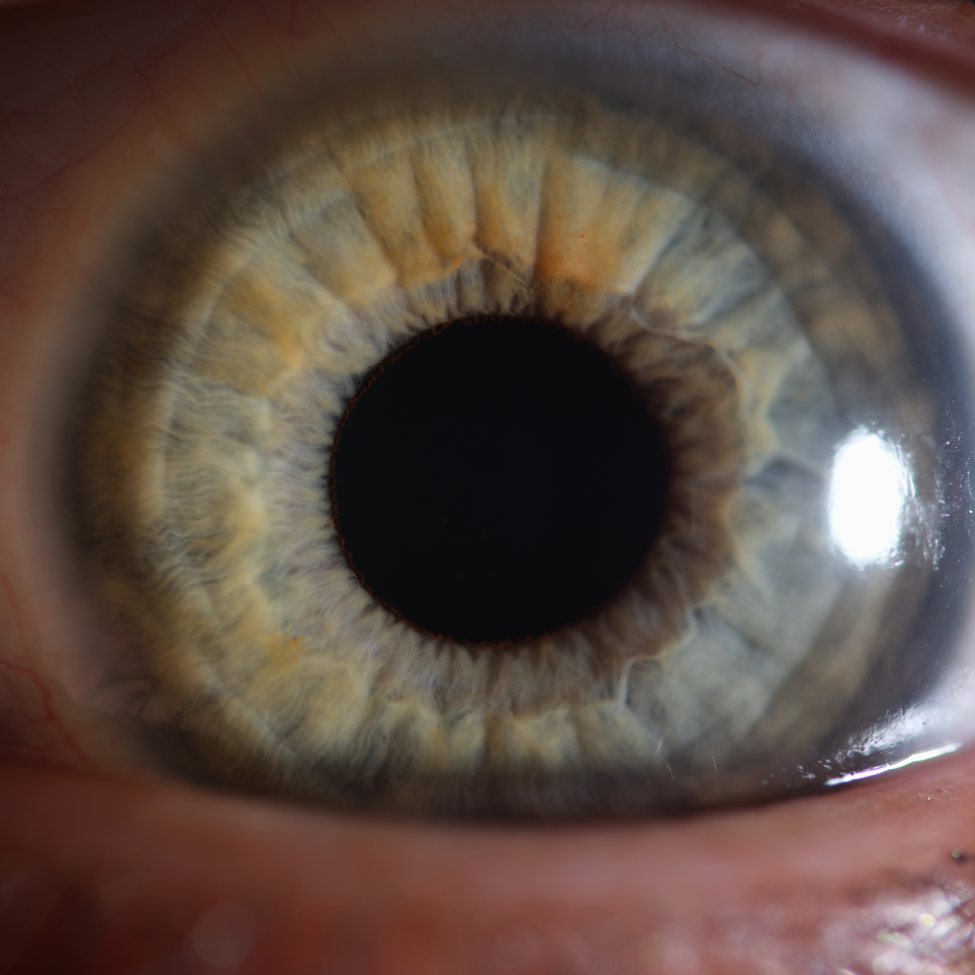 grey eye